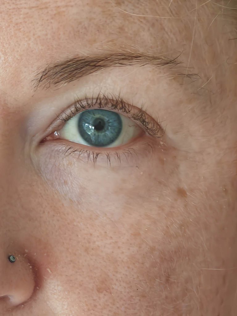 Day 1 Day 1