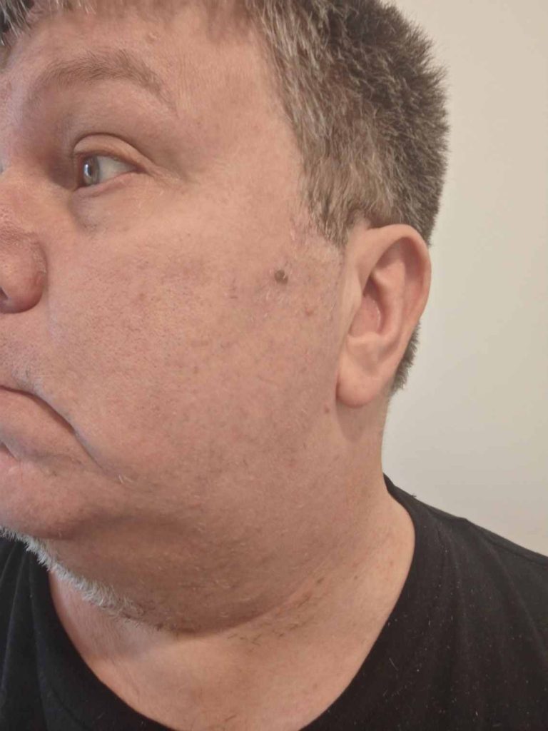 Philips Shaver 3000 series closer look at halfway Philips Shaver 3000 series closer look at halfway