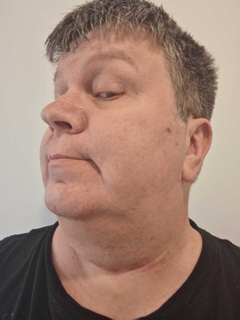 Philips Shaver 3000 series end result pic 2 Philips Shaver 3000 series end result pic 2